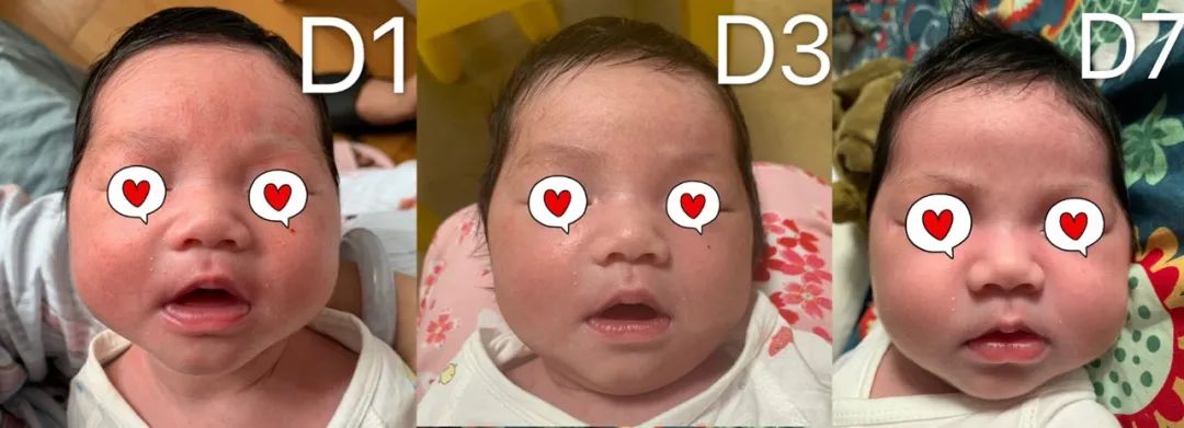 冬天宝宝脸干燥可以涂什么护肤品,儿童护肤冬季防皲裂