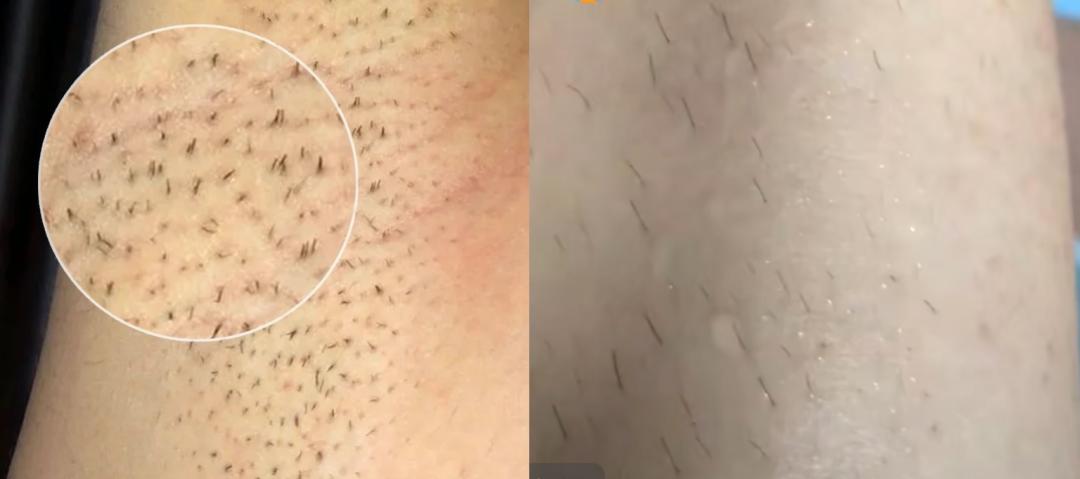 腿粗暗沉粗糙？为什么教程也救不了你的颜值bug？