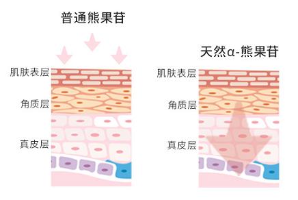 推荐一下你们用过的最好的祛斑霜,公认十大最好的祛斑霜