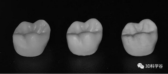 3D打印陶瓷牙冠可靠吗?请参考来自上海与欧洲口腔科研机构的研究