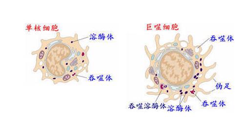 炎症的自述：发生、机理和结局