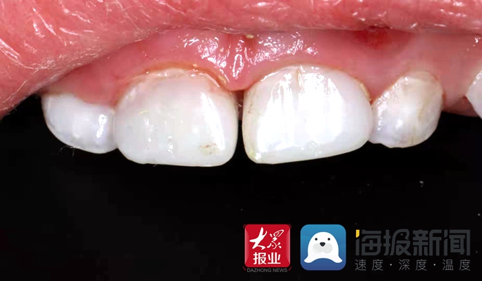 菏泽市立医院口腔科补牙多少钱,菏泽市立医院口腔科专业