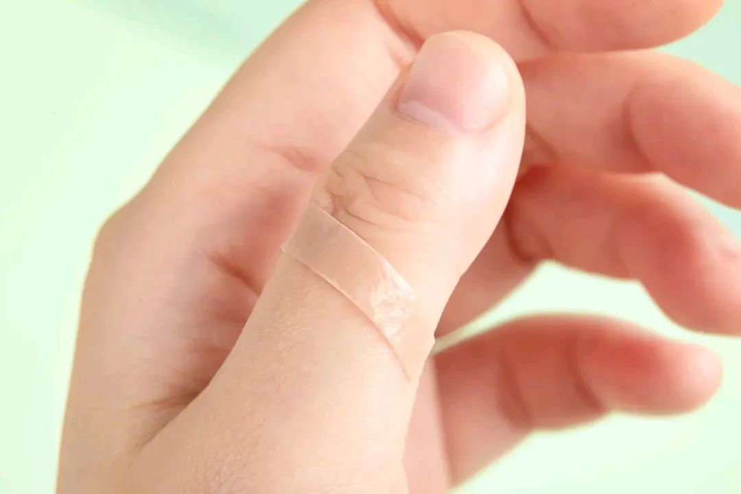 贴上就能消除疤痕是真的吗,脸上有疤如何淡化疤痕