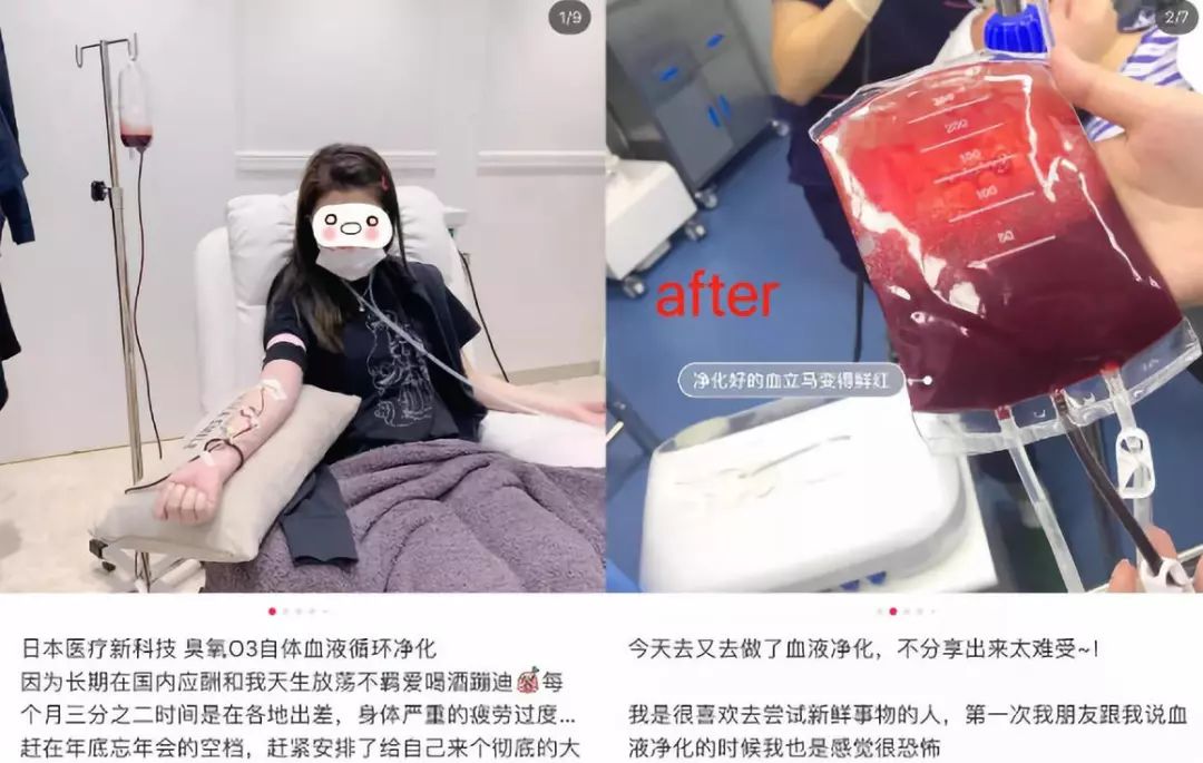 最近韩国瘦脸针事件新闻,韩国瘦脸针有国家批文了吗