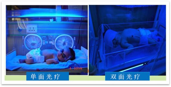 健康育儿早知道新生儿黄疸,新生宝宝病理性黄疸如何治疗