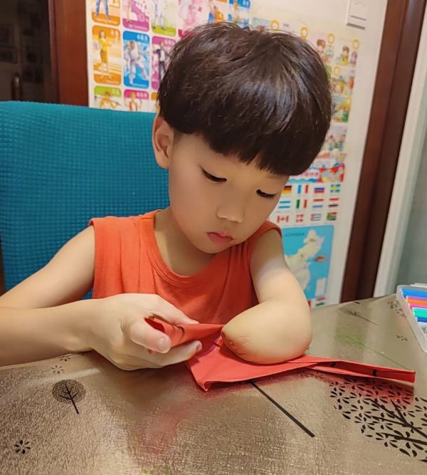 7岁男孩忍痛学跳绳,南通7岁独臂男孩忍痛学跳绳