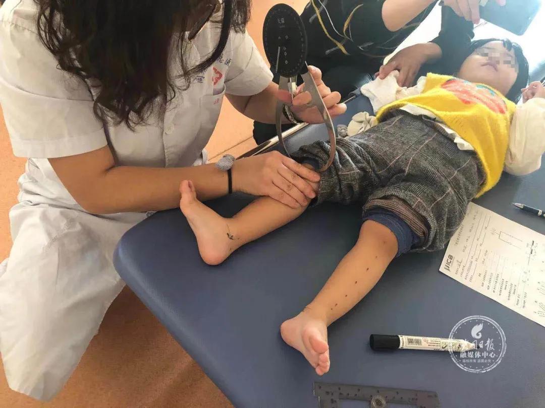 张丽琴大同,张丽琴医生