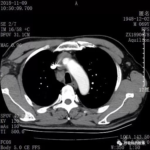 怎么应用统计学做调查,统计学方法可以解决的主要问题