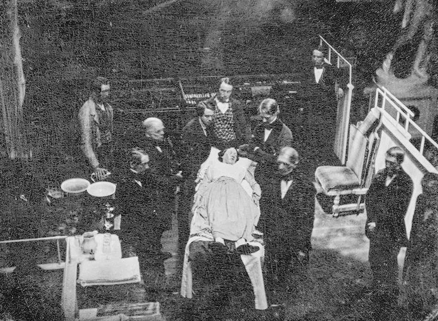 剖宫产的真实故事,剖宫产经历九死一生