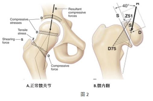 小孩走路不稳摇摇晃晃,孩子走路摇晃怎么回事
