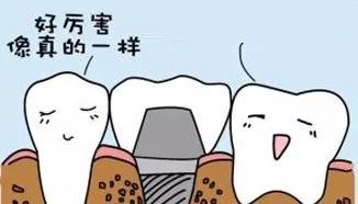 种植牙后对牙齿美学的改变,种植牙齿最后一步需要注意什么