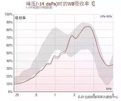 耳硬化症通过什么检查,耳硬化症的诊疗计划