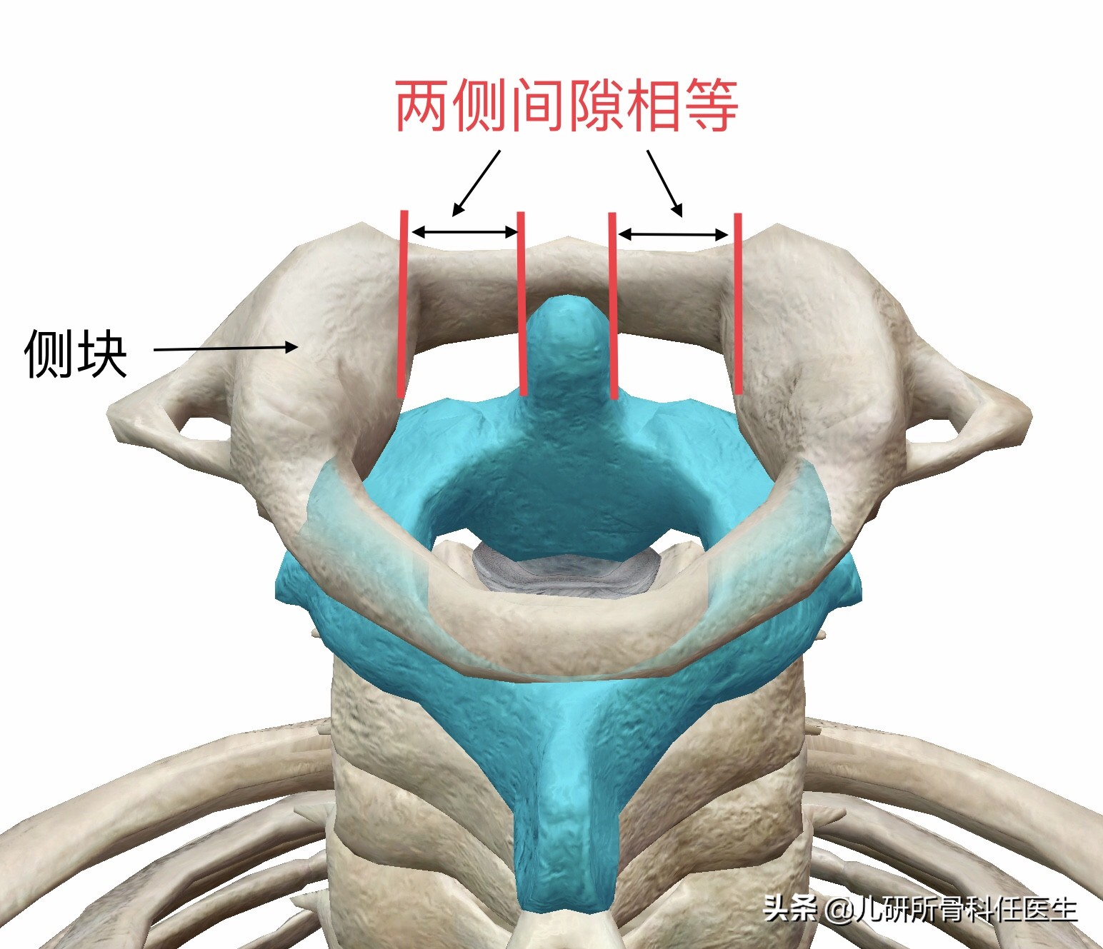 宝宝脖子突然歪了怎么办,小孩脖子落枕了头一直歪着怎么办