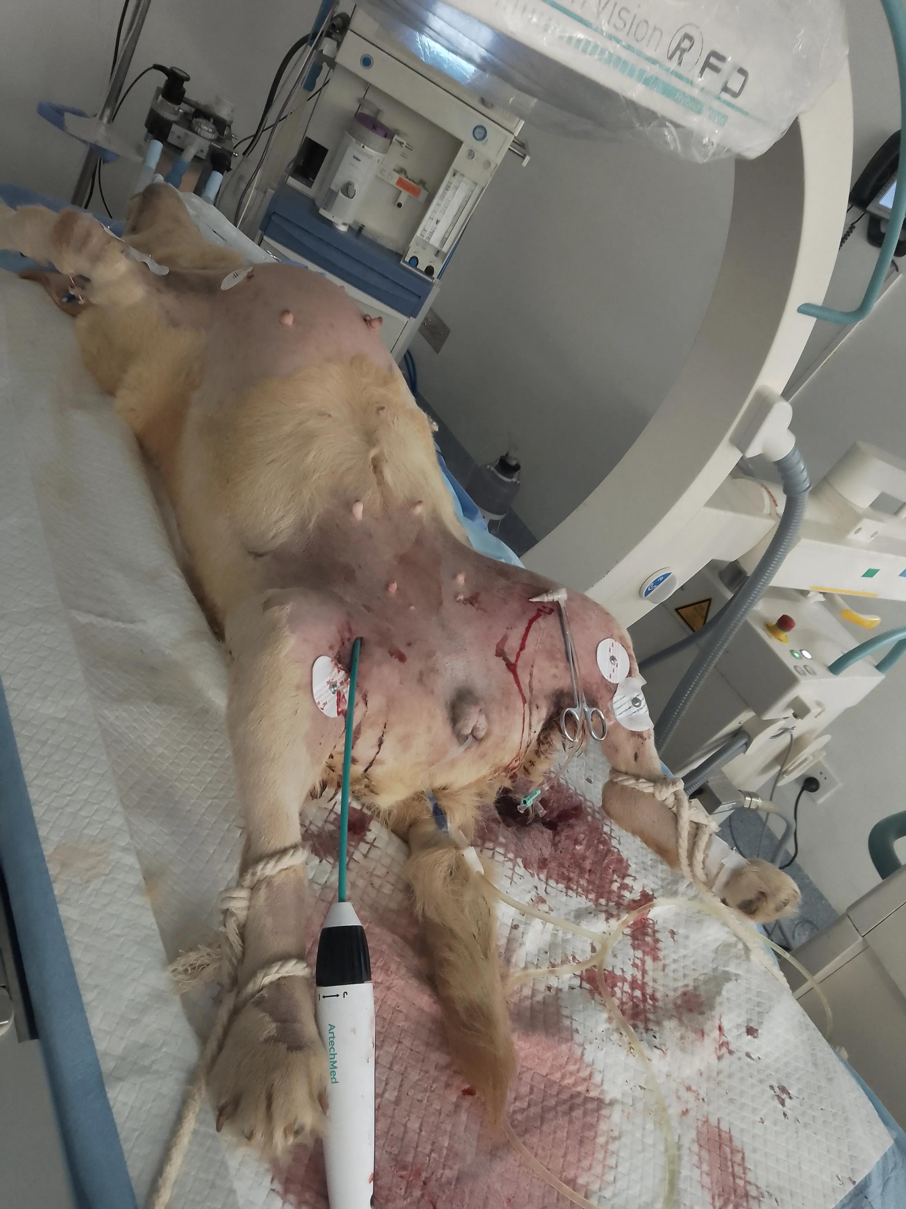 房颤射频消融术器械有哪些,脉冲消融治疗房颤品牌