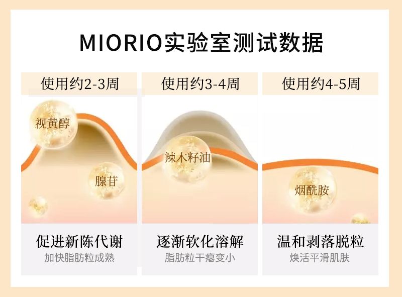 脂肪粒别用针挑教你一个土办法,脂肪粒怎么用针挑出来不疼