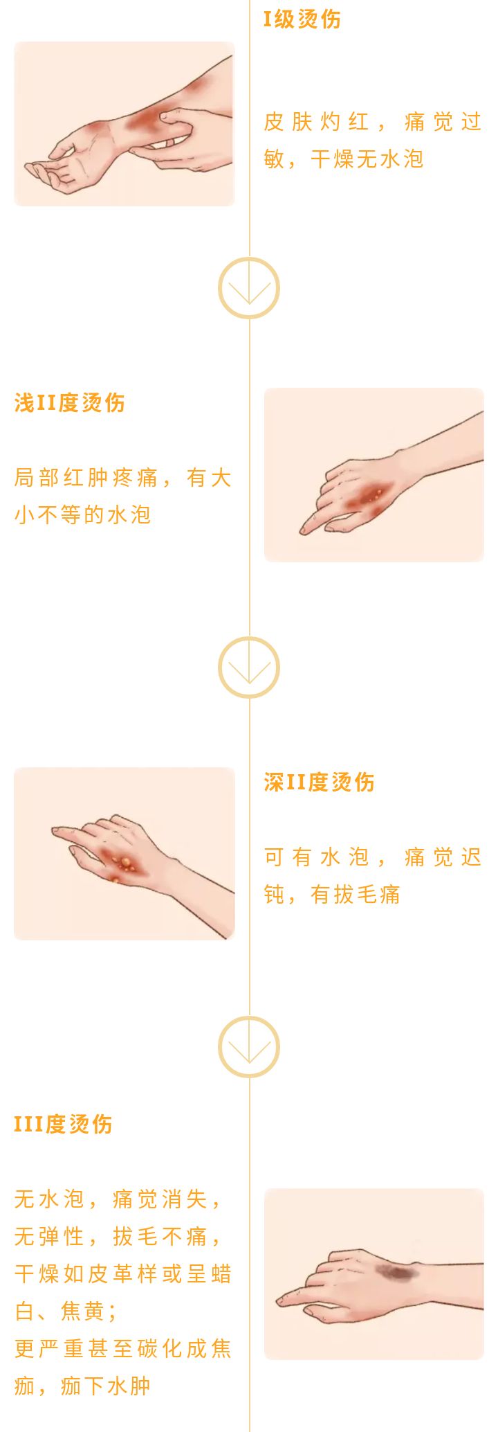 老人烫伤护理操作视频,老人在养老院被烫伤赔偿责任
