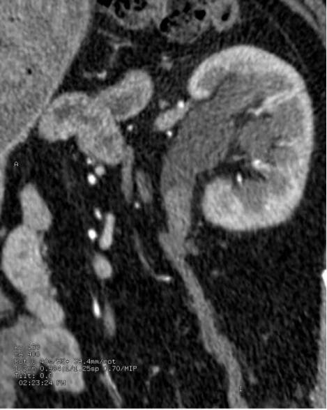 造影检查对身体的伤害大吗,造影对一般检查有必要吗