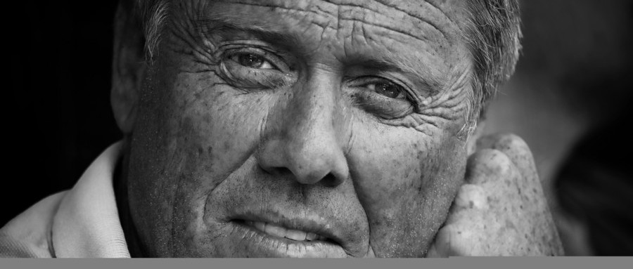 老年斑消除最好的方法男性,老年斑消除最快最有效方法