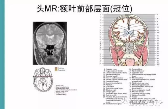 mra头颅解剖学详细讲解视频,常见的头颅mri图像