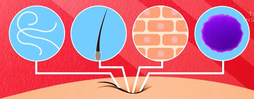 肚脐眼太脏了怎么处理,肚脐眼里面为啥有很多脏东西