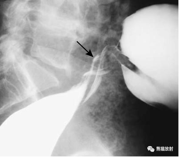 腹部影像图片大全,乙状直肠疼痛位置图片