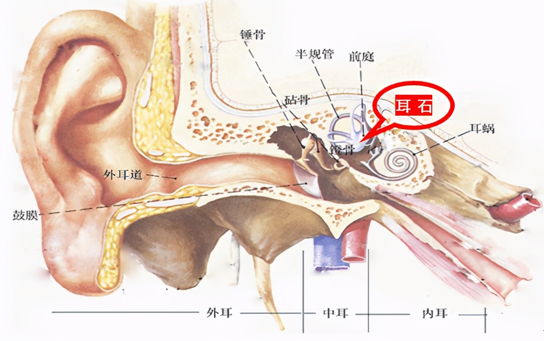 耳朵里面找金箍棒,耳朵里有定海神针怎么办