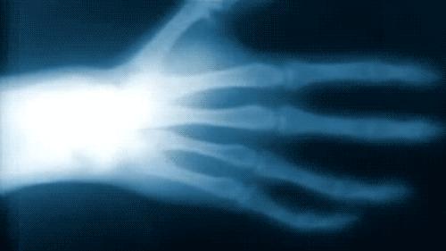 什么是x射线y射线,什么是x射线检测