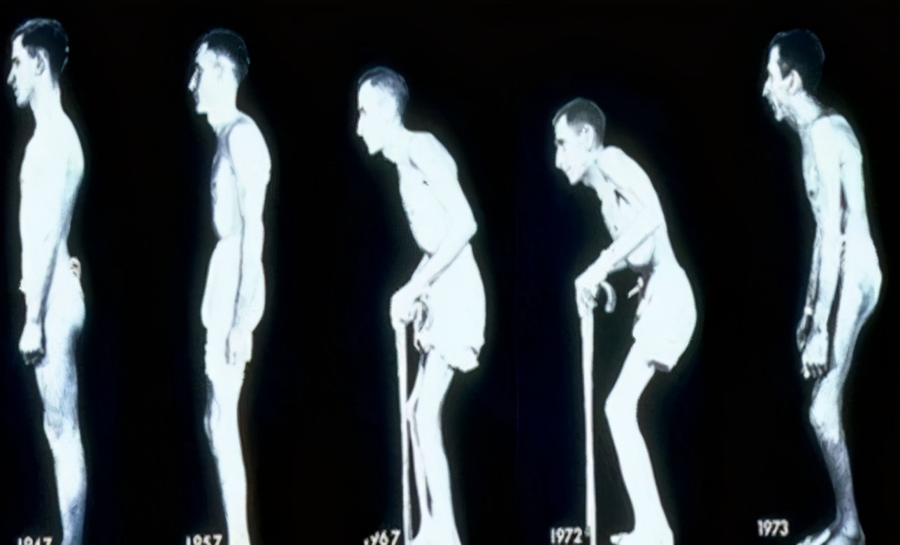 10月12日世界关节炎日义诊宣传,送温暖健康义诊