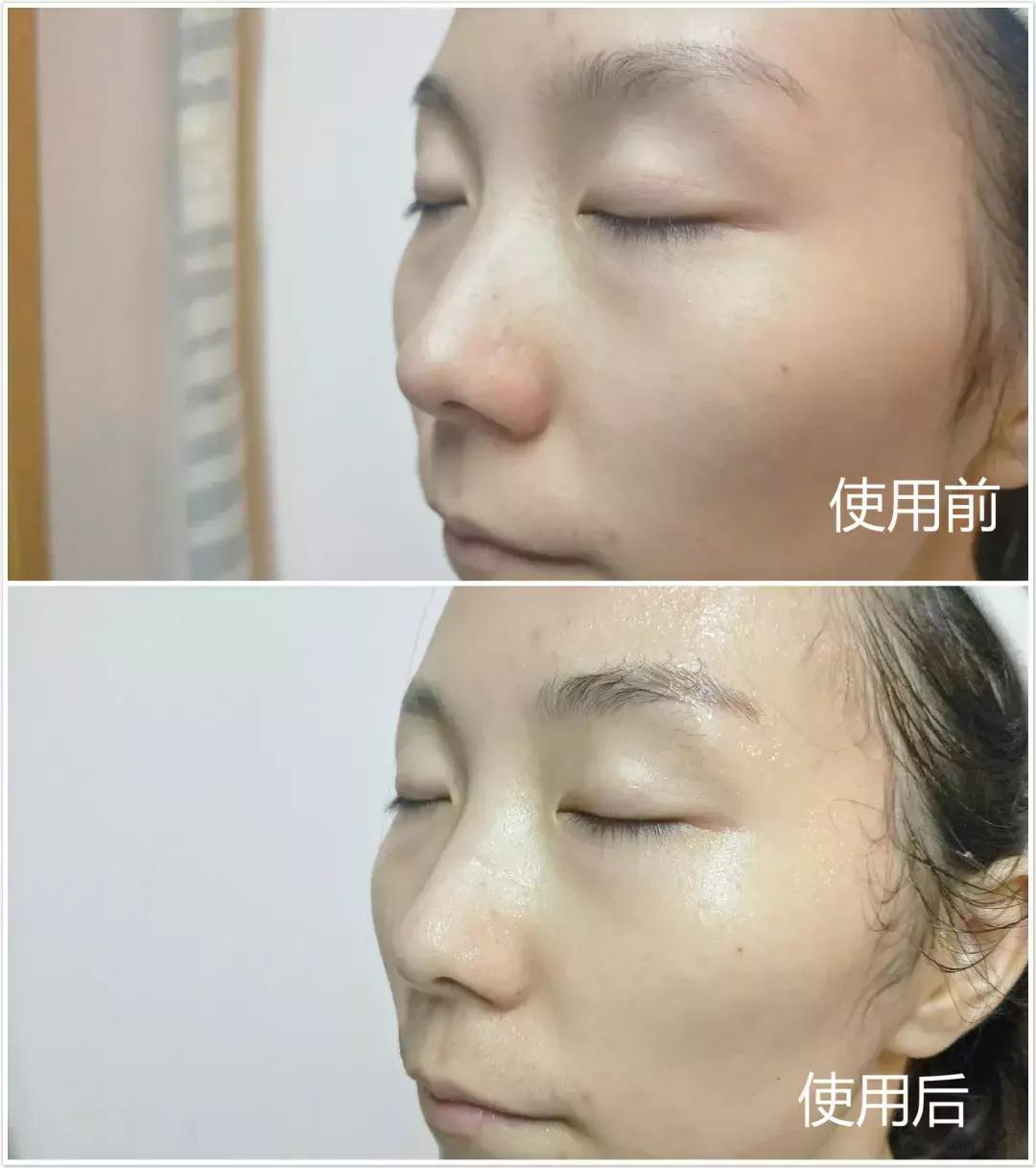 新西兰8分钟面膜三种颜色的功效,新西兰好的面膜