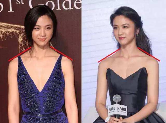 三个姿势改善体态,3个让人变丑的动作