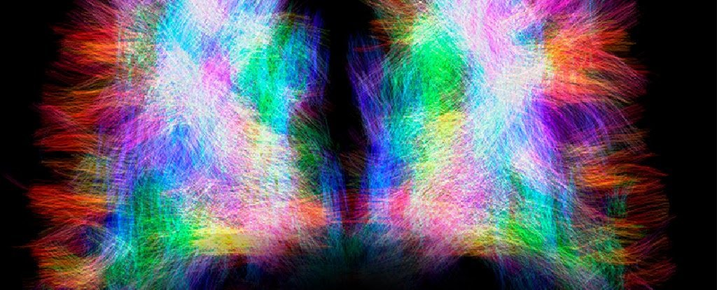 天生智障却创造最强大脑的奇迹,残缺的大脑