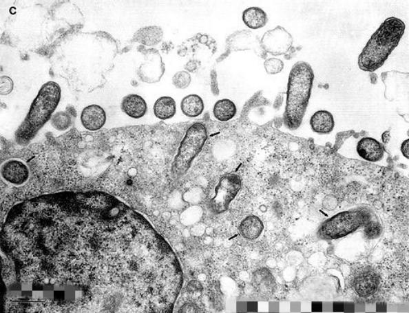 医学史上的2月9日：立克次体发现者、美国病理学家霍华德出生