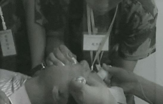 电击恶魔杨永信,杨永信电击的孩子后遗症