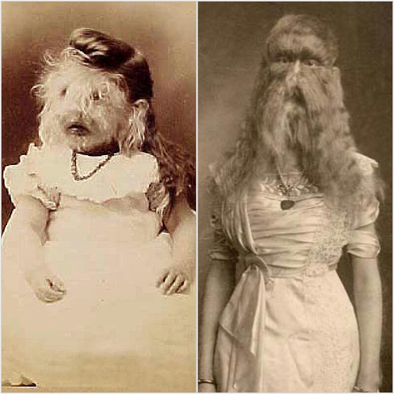 金毛狮王头发是什么根,金毛狮王的头发怎么处理