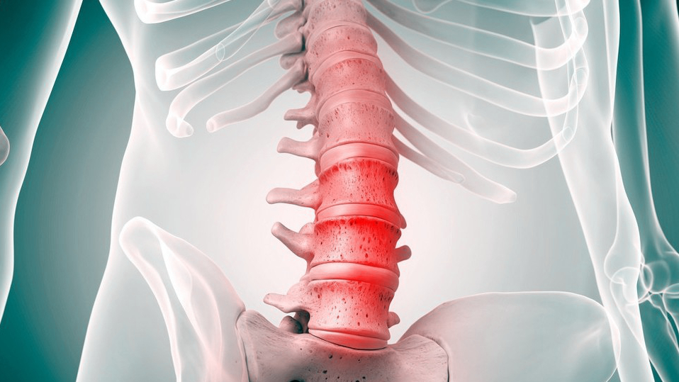 腰椎压缩性骨折保守100天能坐多久,腰椎骨折保守治疗100天可以弯腰吗