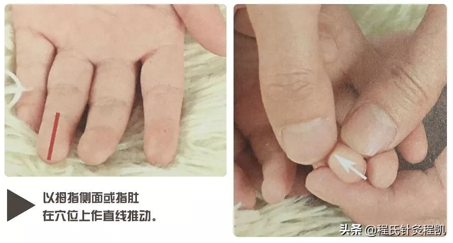 秋季孩子身上起荨麻疹怎么办,秋季小孩出麻疹