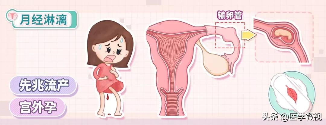 月经的颜色是暗红色是什么原因,月经推迟鲜红色是怎么回事