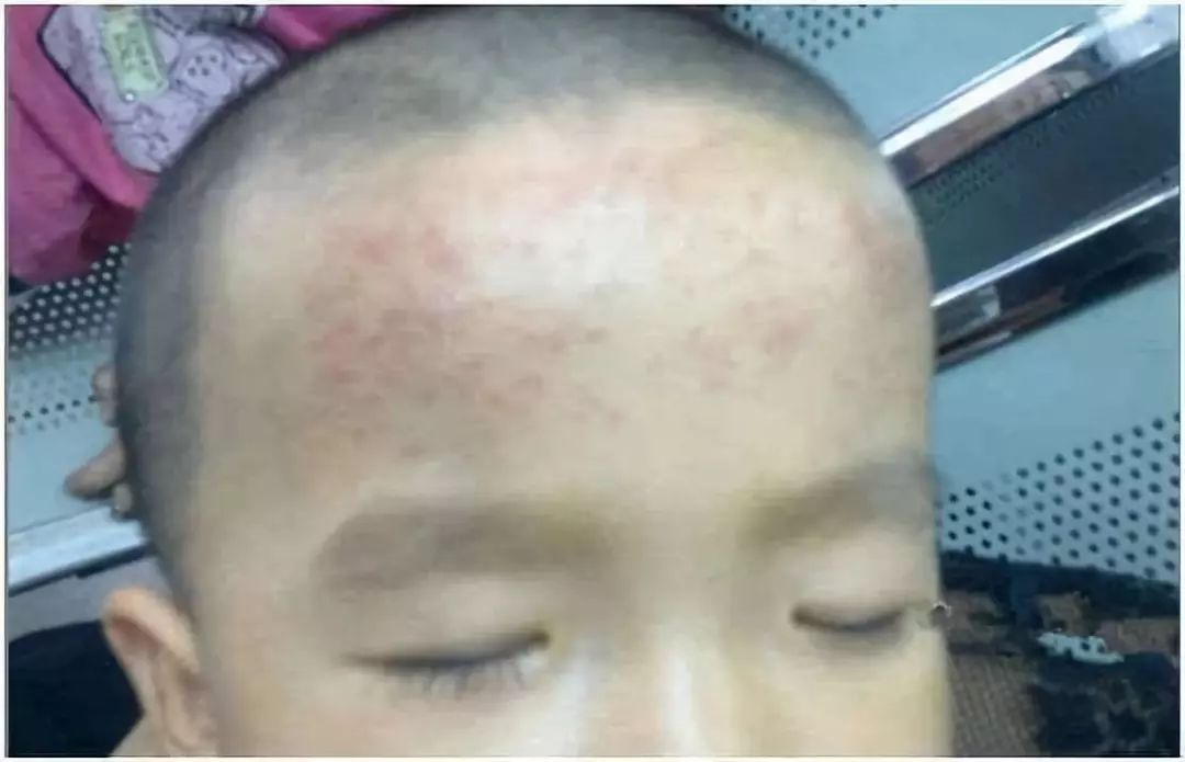 退热贴育儿,小儿退热贴骗局