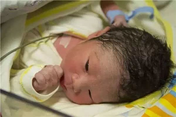 顺产时应该注意哪些事项,顺产整个流程及注意事项