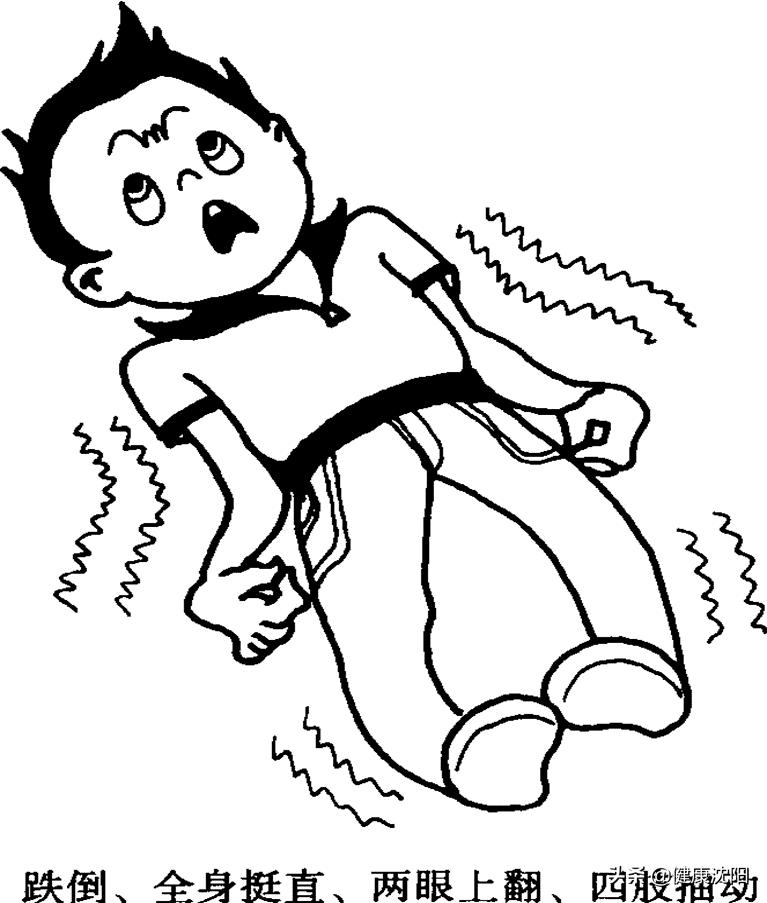 世界癫痫日科普知识,世界癫痫日癫痫发作及时正确处理