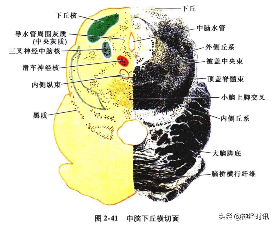 脑干解剖,脑干神经解剖