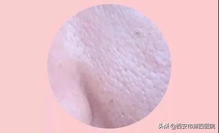 毛孔粗大的正确护肤方法,毛孔粗大正确护肤方法