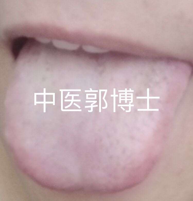 经常夜班头疼,经常夜班怎么补救