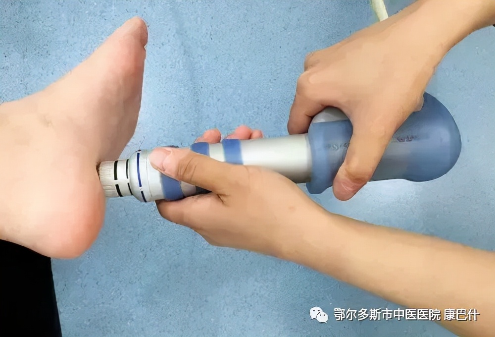 足底筋膜炎运动康复视频,认识足底筋膜炎如何预防和康复