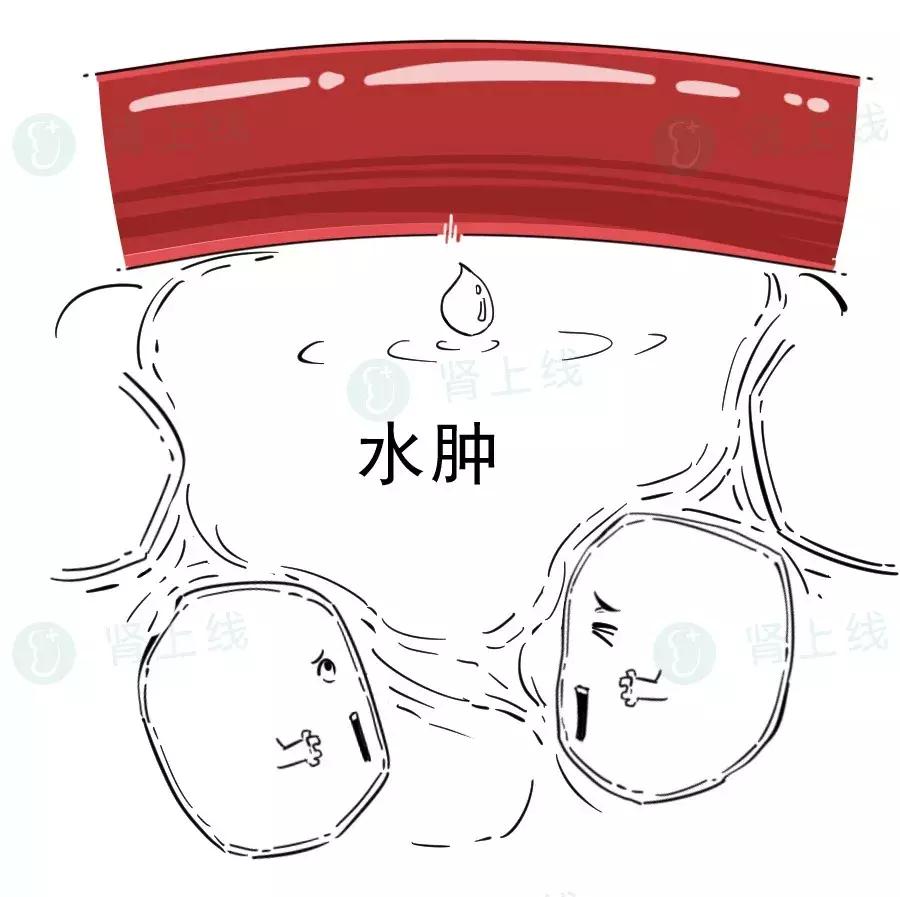 肾不好是上眼皮肿还是下眼皮浮肿,肾不好是双脚肿还是单脚肿