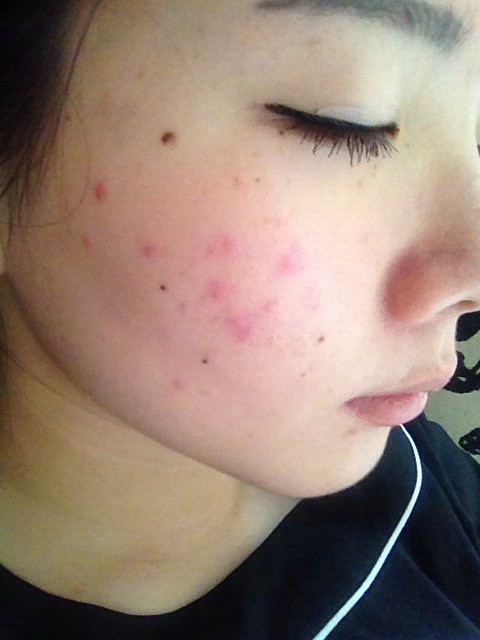 用了成百上千张化妆棉，皮肤却越来越薄了，原来是打开方式不正确