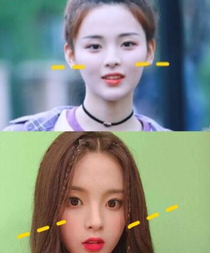 人中长颧骨高适合什么发型,人中长太阳穴凹陷