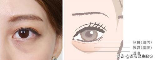 关掉美颜黑眼圈,关掉美颜眼睛更清纯