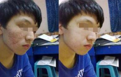 12岁男孩只有136cm,父母着急不已,半年后孩子却长到了152cm!