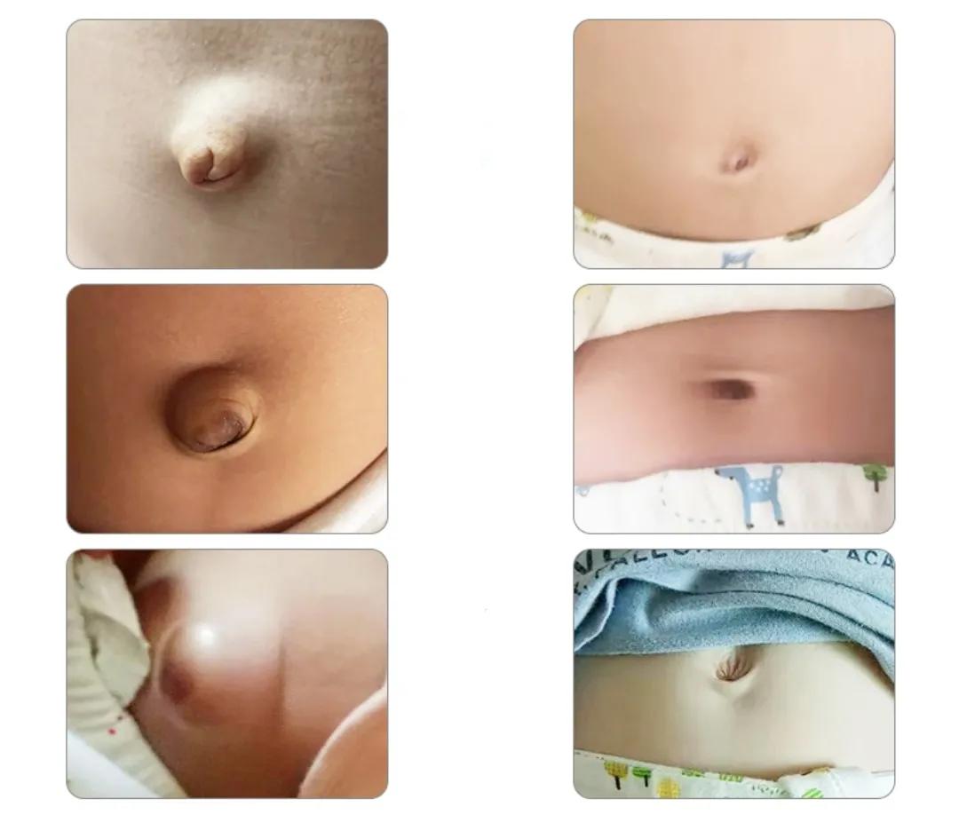 新生儿常见若干问题及解决办法|实用篇